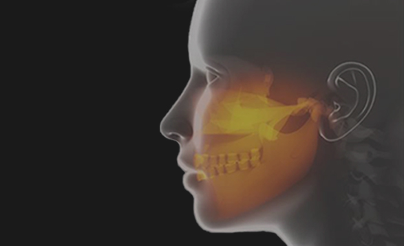 CONE BEAM TOMOGRAPHY