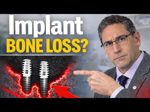 Bone Loss Around Dental Implants: Can Gum Grafting Help Save Your Implant?