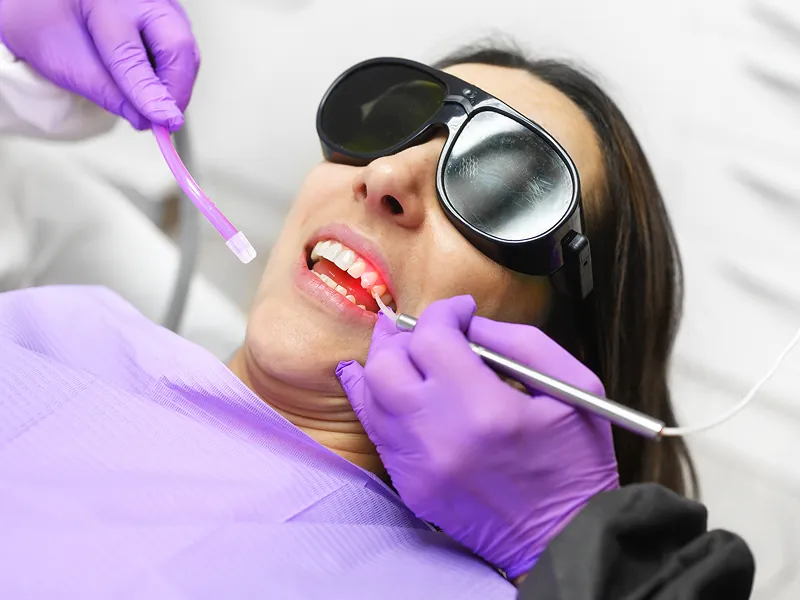 Patient in protective glasses undergoing professional laser teeth whitening treatment with bright clinical lighting and purple dental gear.
