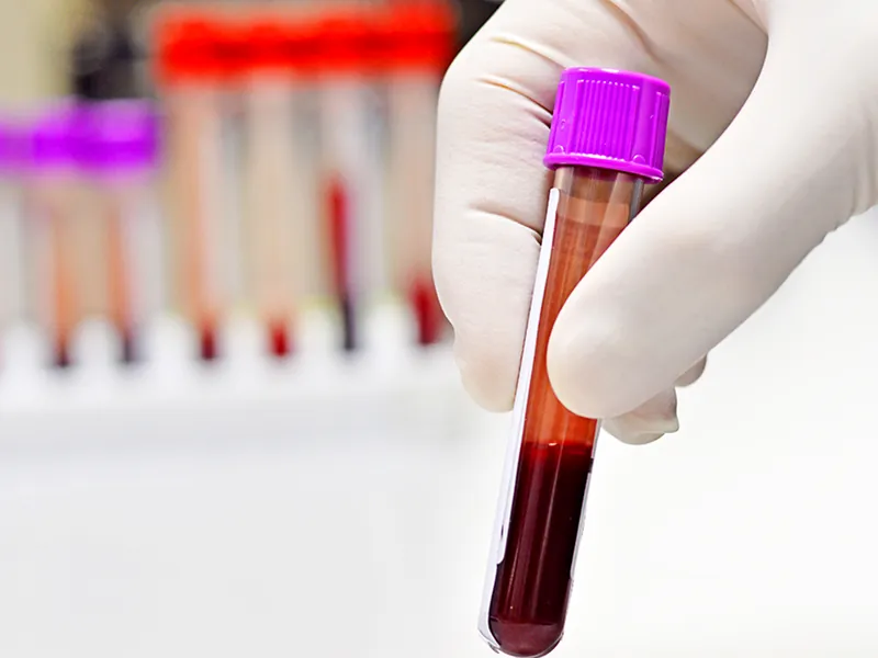 Gloved hand holding a purple-capped blood collection tube under bright lab lighting, with blurred test tubes in the background.